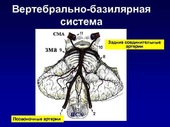    Факторы риска инсульта • Наследственная предрасположенность • Возраст   