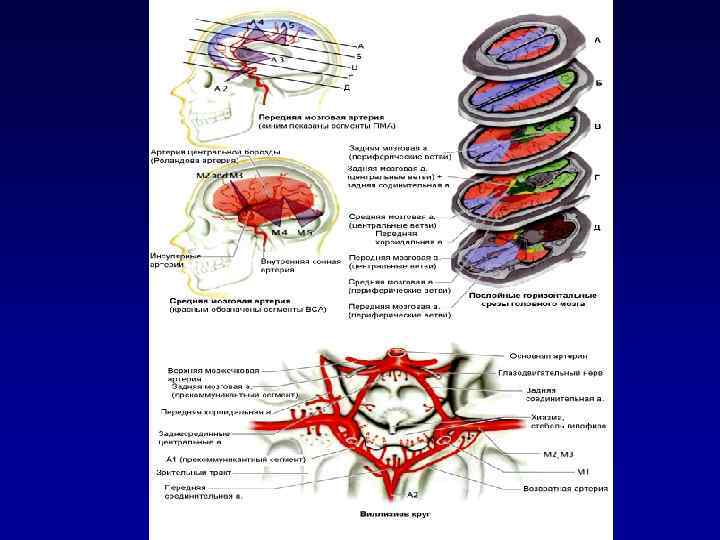 Основные патогенетические факторы  ОНМК по ишемическому типу морфологические изменения сосудов   стенозы,