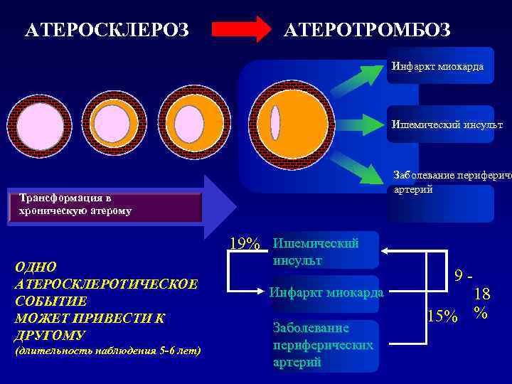 АТЕРОСКЛЕРОЗ КРУПНЫХ АРТЕРИЙ  ДИАГНОСТИЧЕСКИЕ ПРИЗНАКИ l  Наличие шума над магистральными артериями (сонной,