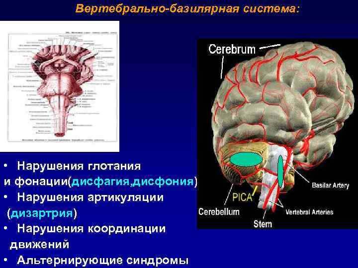 ТЕЧЕНИЕ ИНСУЛЬТА • Острейший период – 3 -7 дней  • Острый период