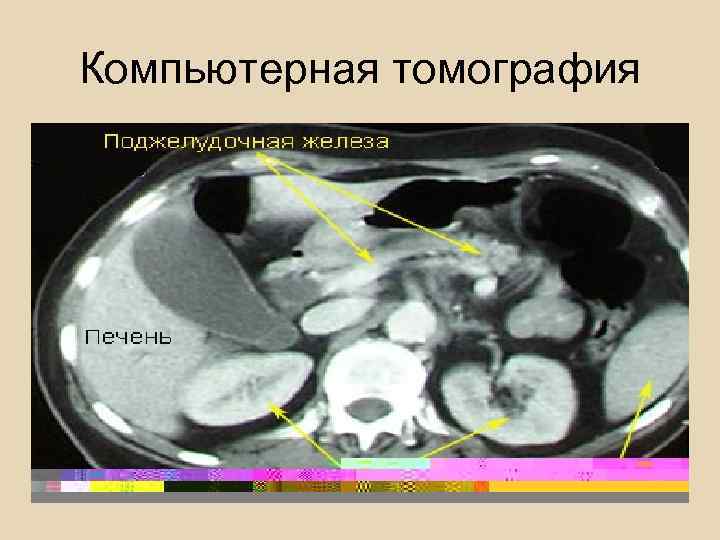  Доврачебная неотложная помощь фельдшером СМП отёчная форма: 1. Покой, Фовлеровское положение; 2. Голод;