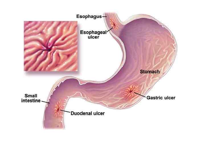    СУТЬ НЕРВНО -  РЕФЛЕКТОРНОЙ ТЕОРИИ Причины: экстеро- интеро-  