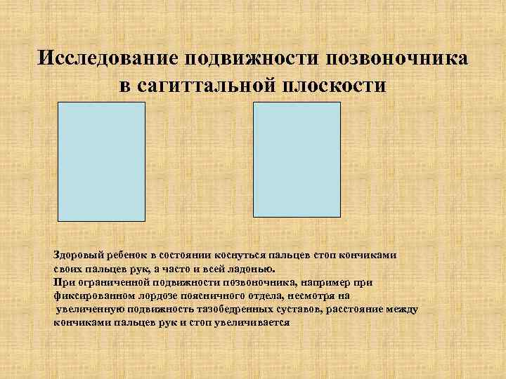 Исследование подвижности позвоночника в сагиттальной плоскости Здоровый ребенок в состоянии коснуться пальцев стоп кончиками