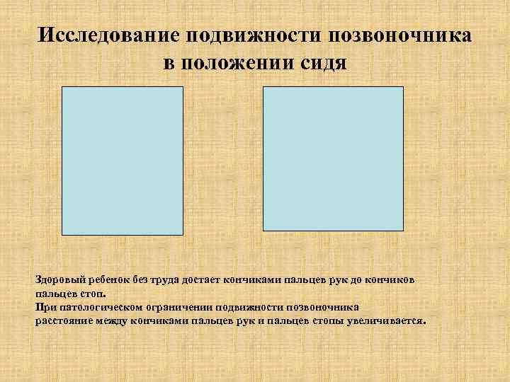 Исследование подвижности позвоночника в положении сидя Здоровый ребенок без труда достает кончиками пальцев рук