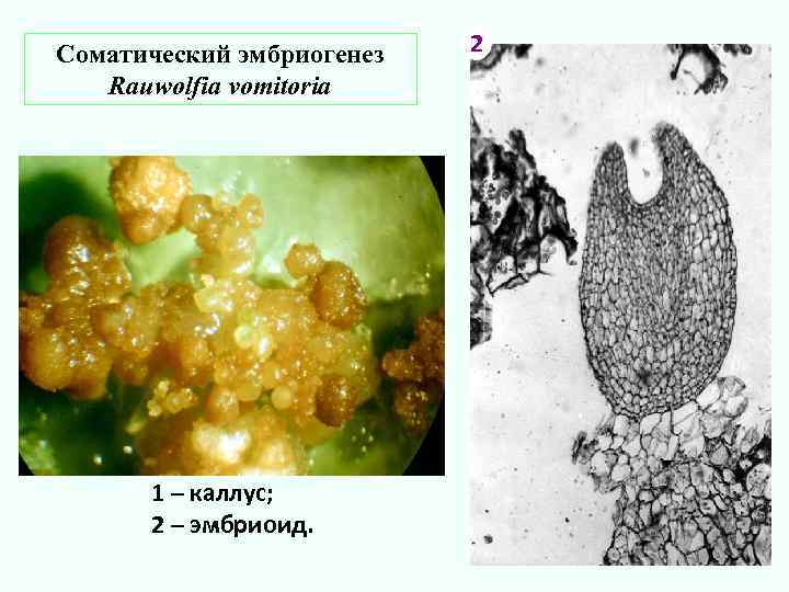 Соматический эмбриогенез 2 Rauwolfia vomitoria 1 – каллус; 2 – эмбриоид. 