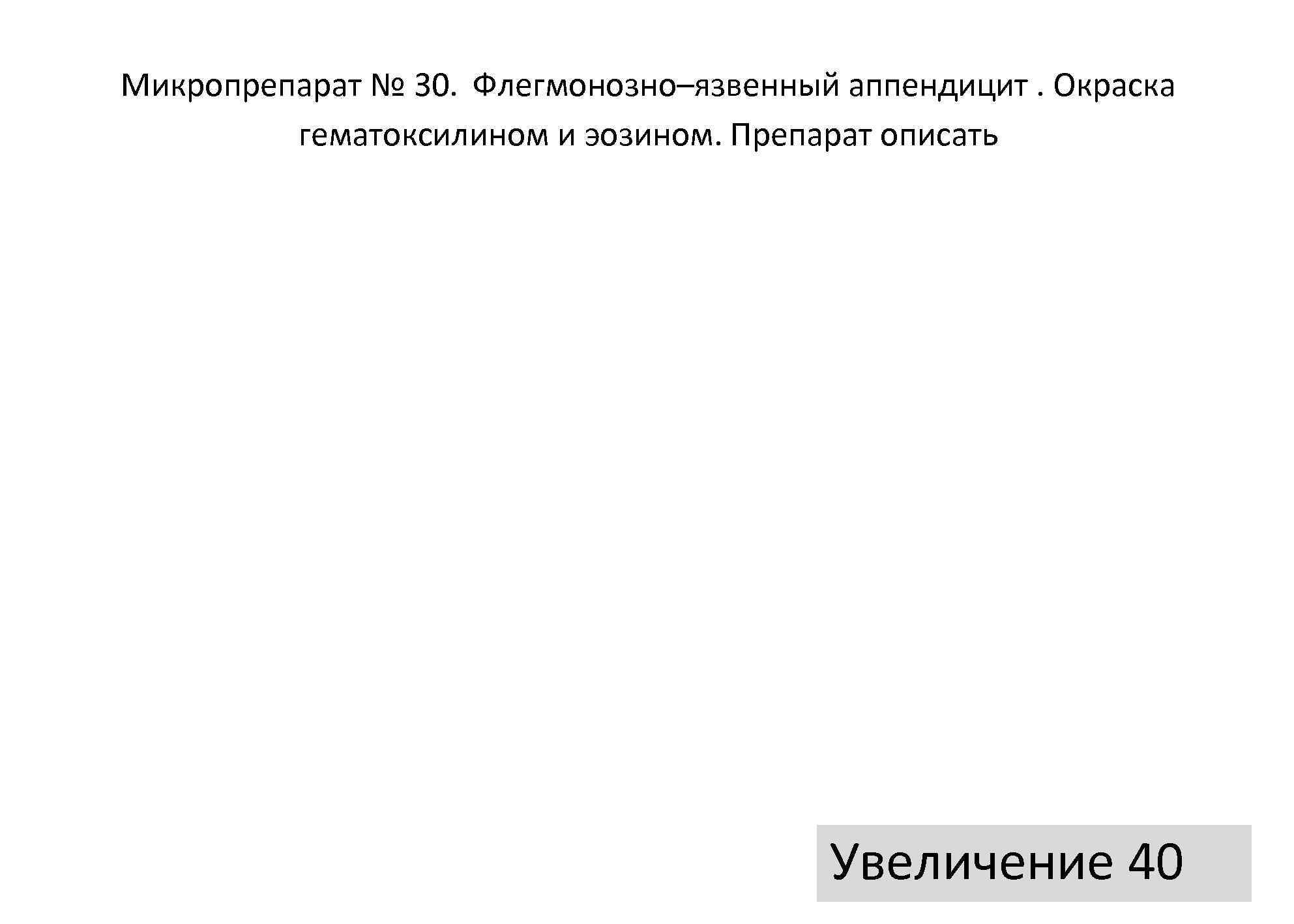 Микропрепарат № 30. Флегмонозно–язвенный аппендицит. Окраска   гематоксилином и эозином. Препарат описать 