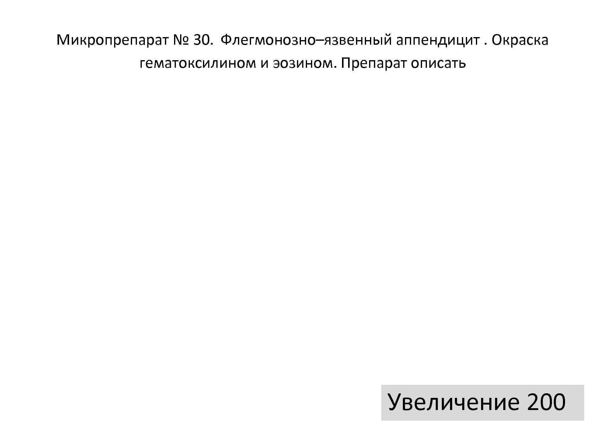 Микропрепарат № 30. Флегмонозно–язвенный аппендицит. Окраска   гематоксилином и эозином. Препарат описать 