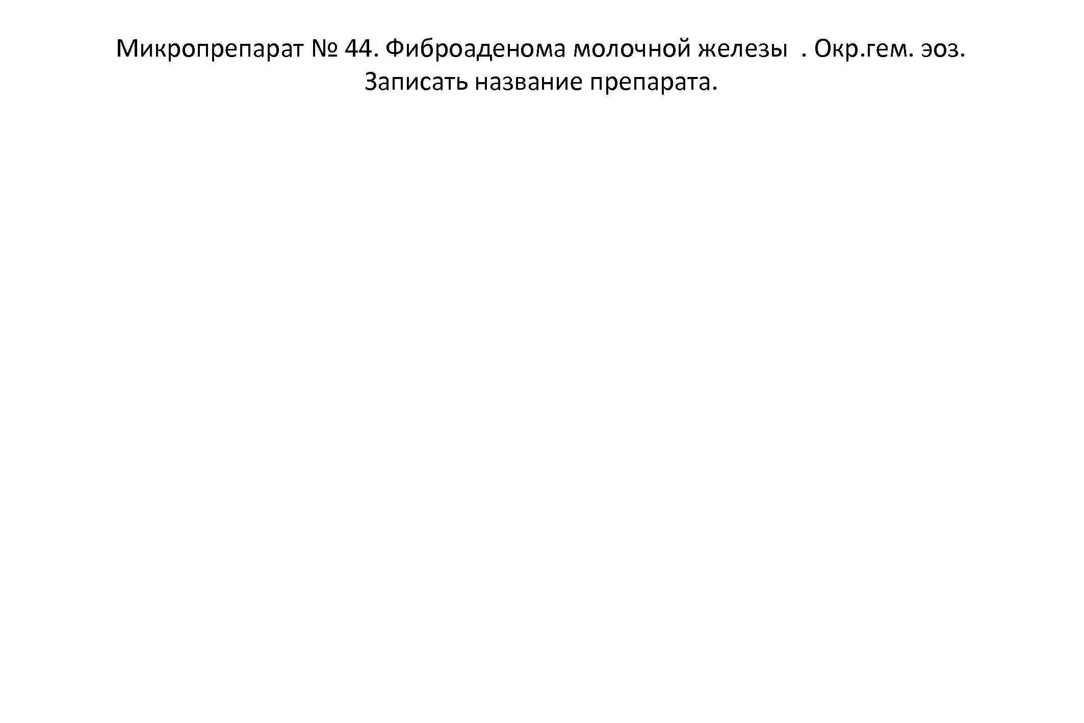 Микропрепарат № 44. Фиброаденома молочной железы. Окр. гем. эоз. Записать название препарата. 