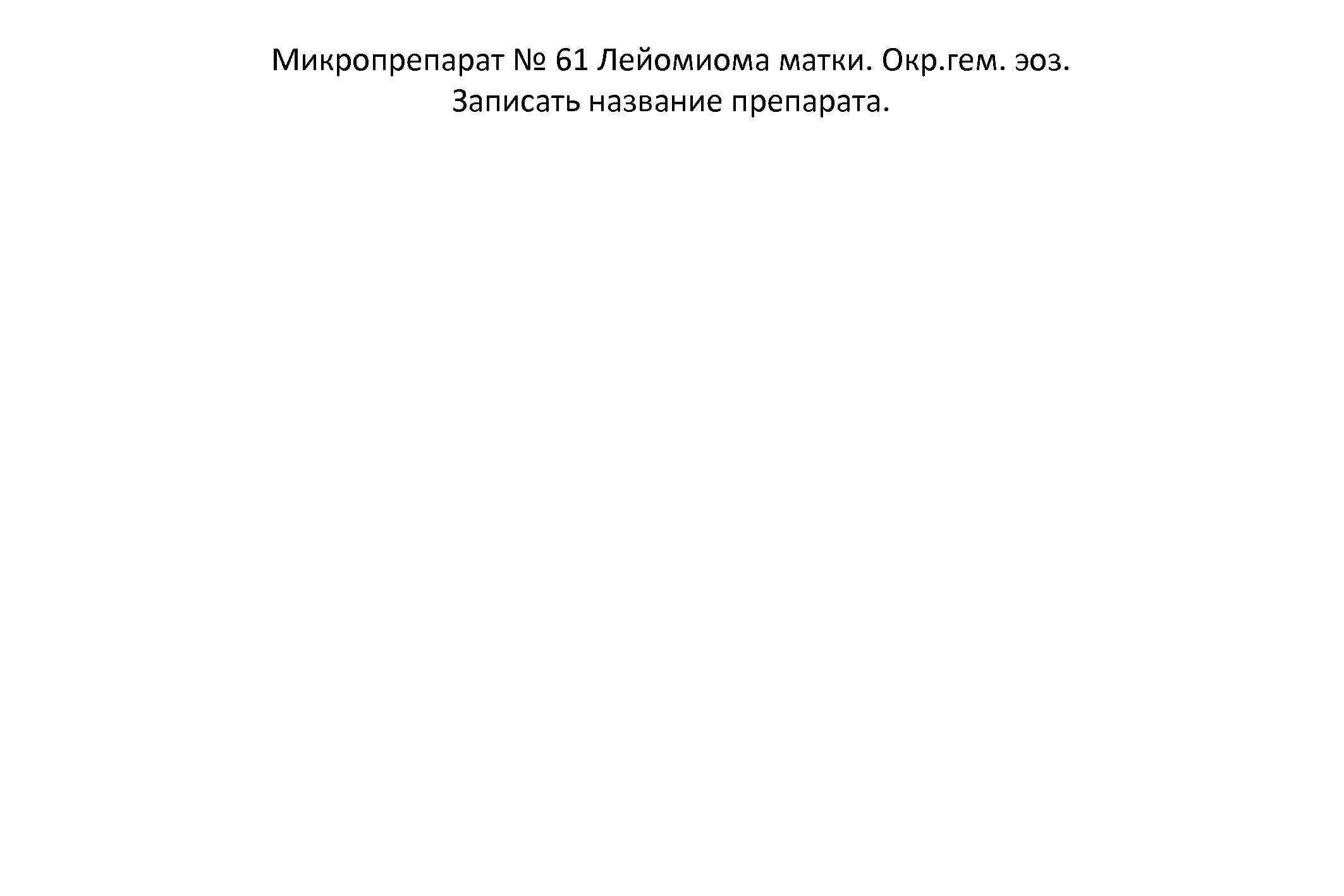 Микропрепарат № 61 Лейомиома матки. Окр. гем. эоз. Записать название препарата. 