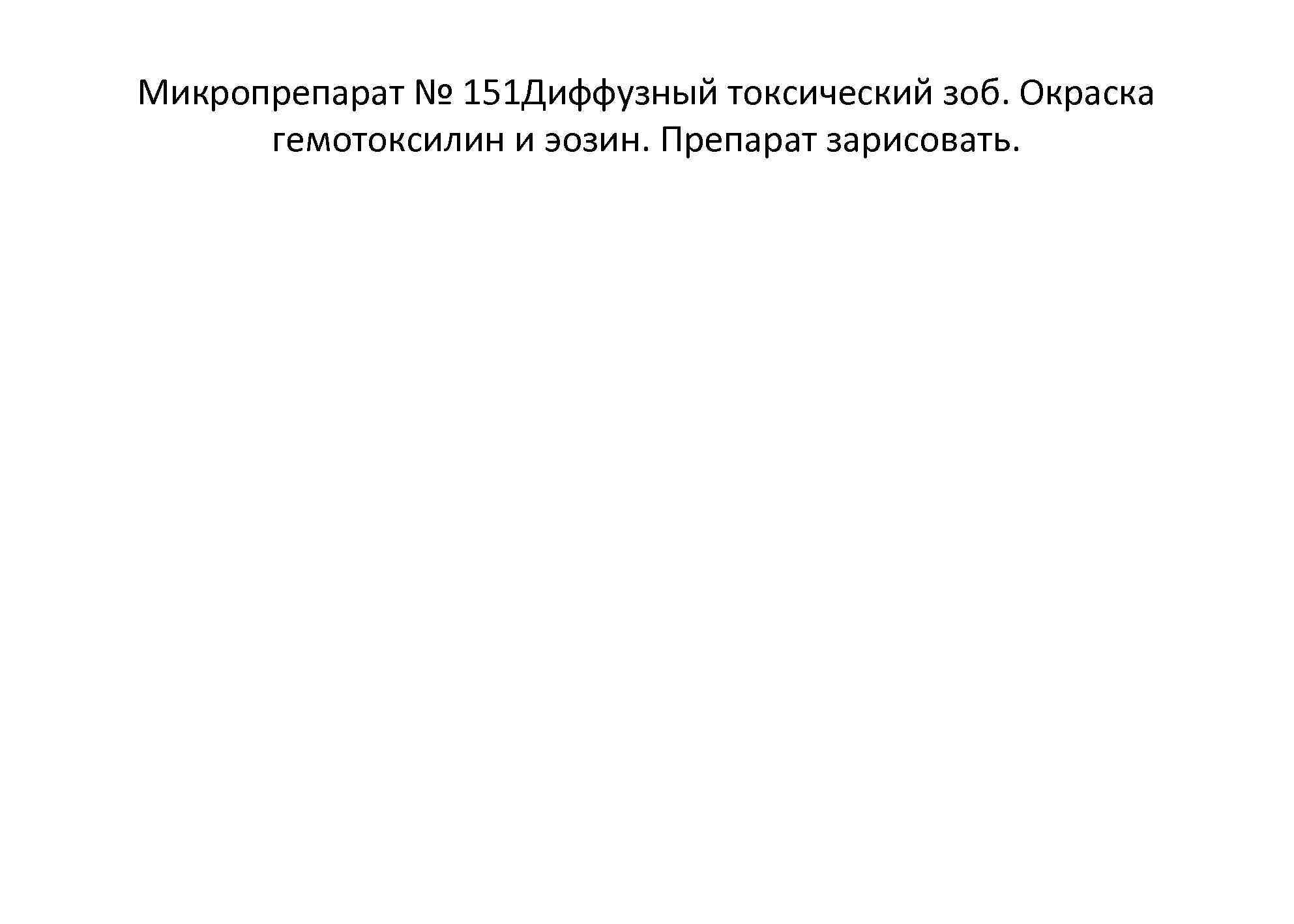 Микропрепарат № 151 Диффузный токсический зоб. Окраска гемотоксилин и эозин. Препарат зарисовать. 