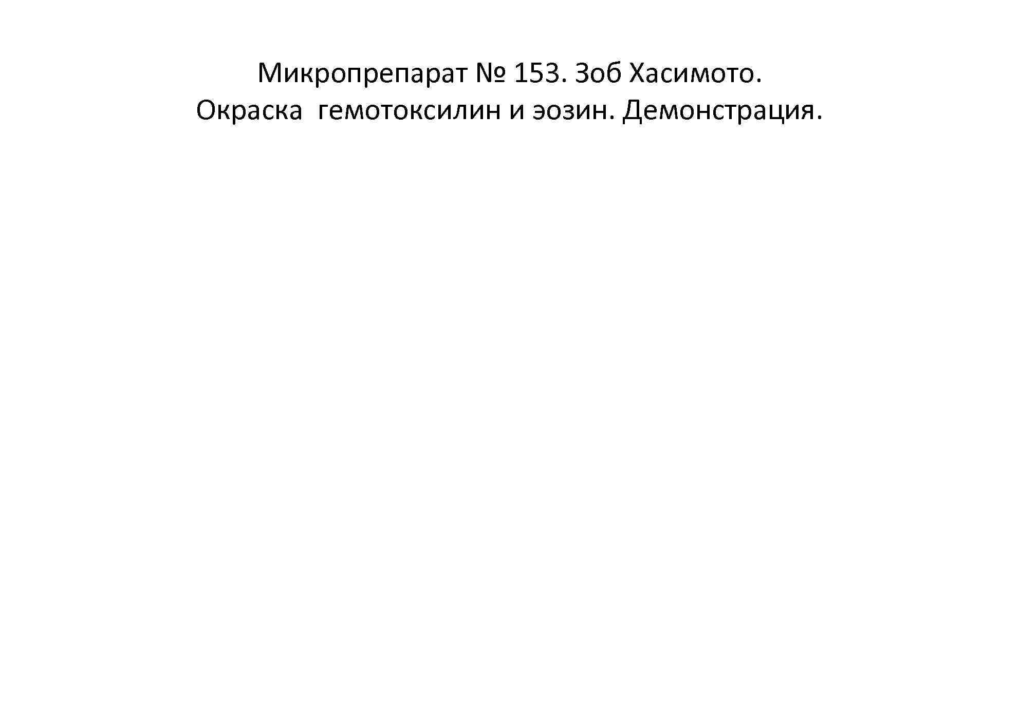  Микропрепарат № 153. Зоб Хасимото. Окраска гемотоксилин и эозин. Демонстрация. 