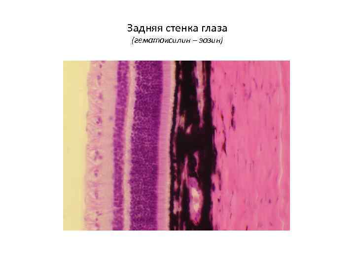 Задняя стенка глаза (гематоксилин – эозин) 