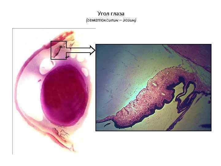  Угол глаза (гематоксилин – эозин) 