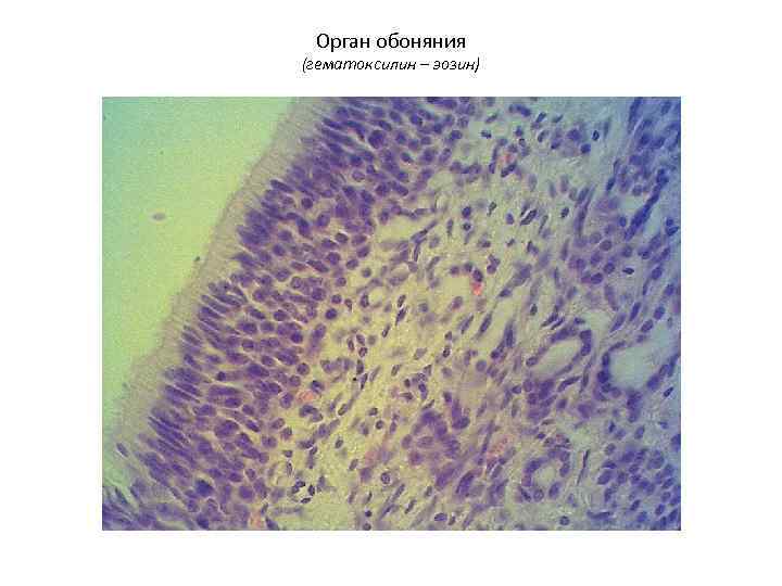  Орган обоняния (гематоксилин – эозин) 