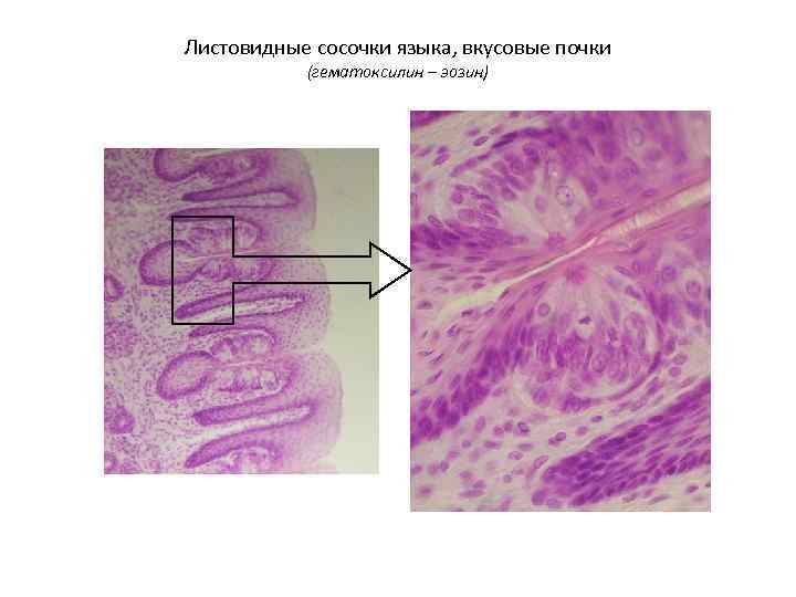 Листовидные сосочки языка, вкусовые почки  (гематоксилин – эозин) 