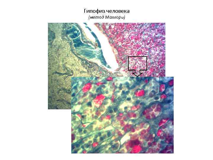 Гипофиз человека (метод Маллори) 
