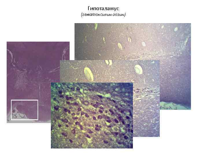  Гипоталамус (гематоксилин-эозин) 