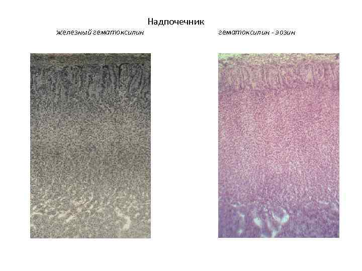     Надпочечник железный гематоксилин - эозин 
