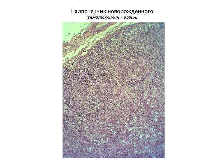 Надпочечник новорожденного (гематоксилин – эозин) 