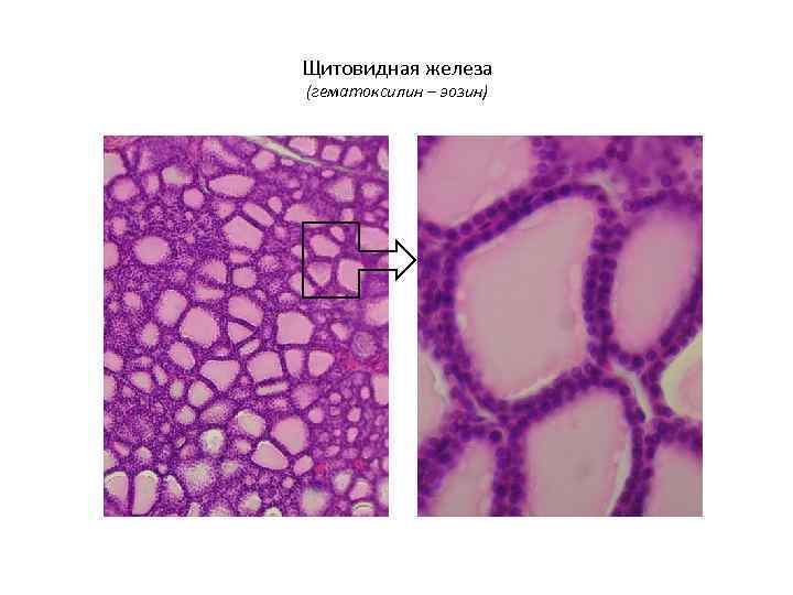 Щитовидная железа (гематоксилин – эозин) 