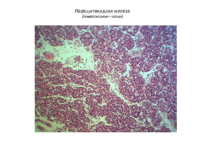 Паращитовидная железа  (гематоксилин – эозин) 