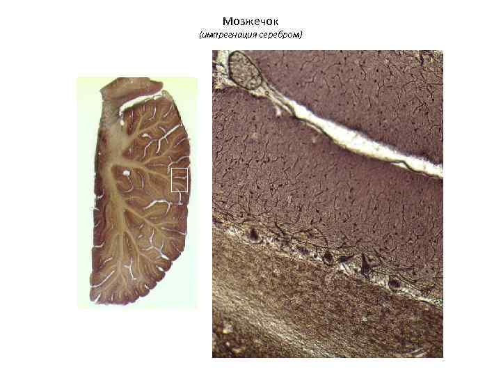  Мозжечок (импрегнация серебром) 