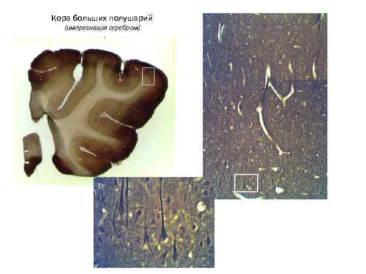Кора больших полушарий  (импрегнация серебром) 