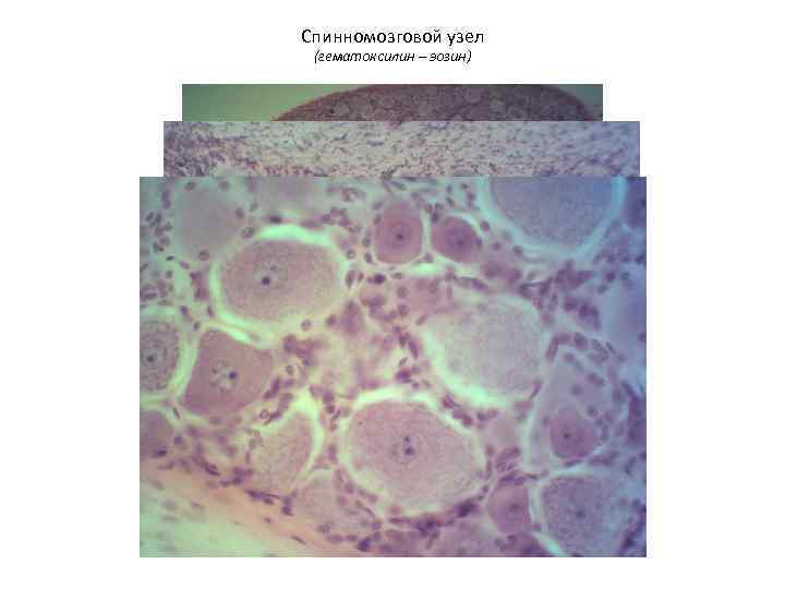 Спинномозговой узел (гематоксилин – эозин) 