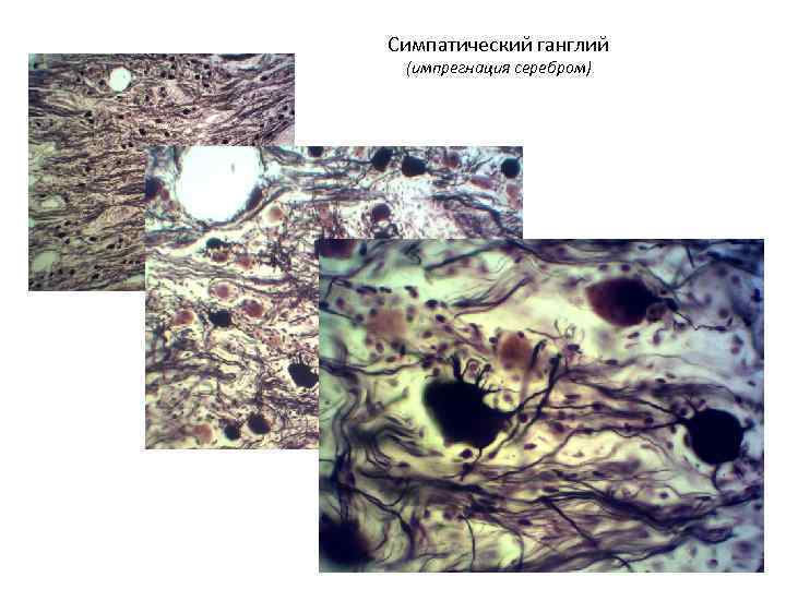 Симпатический ганглий (импрегнация серебром) 