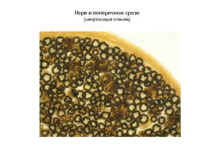 Нерв в поперечном срезе  (импрегнация осмием) 