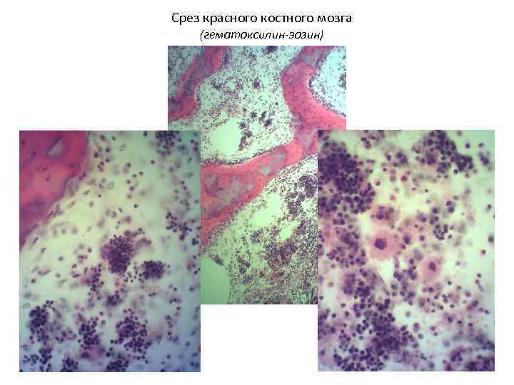 Срез красного костного мозга (гематоксилин-эозин) 