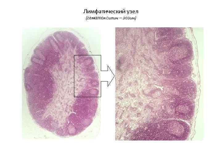 Лимфатический узел (гематоксилин – эозин) 