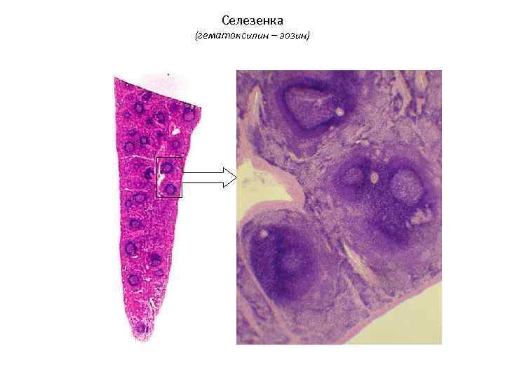  Селезенка (гематоксилин – эозин) 
