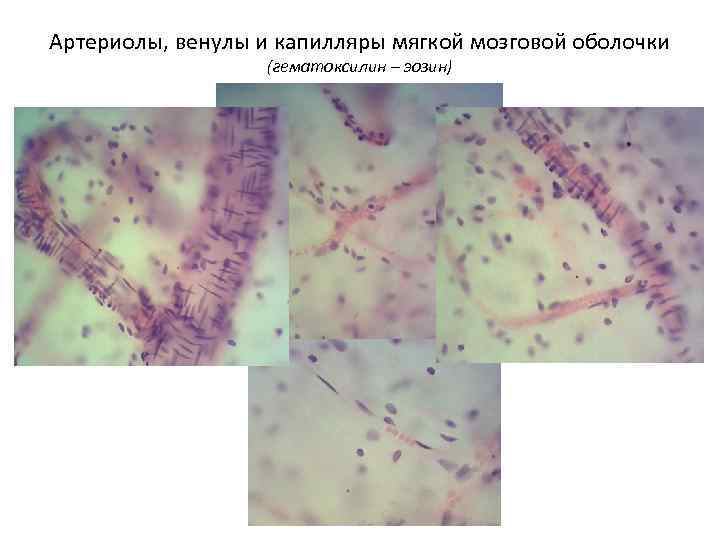 Артериолы, венулы и капилляры мягкой мозговой оболочки (гематоксилин – эозин) 