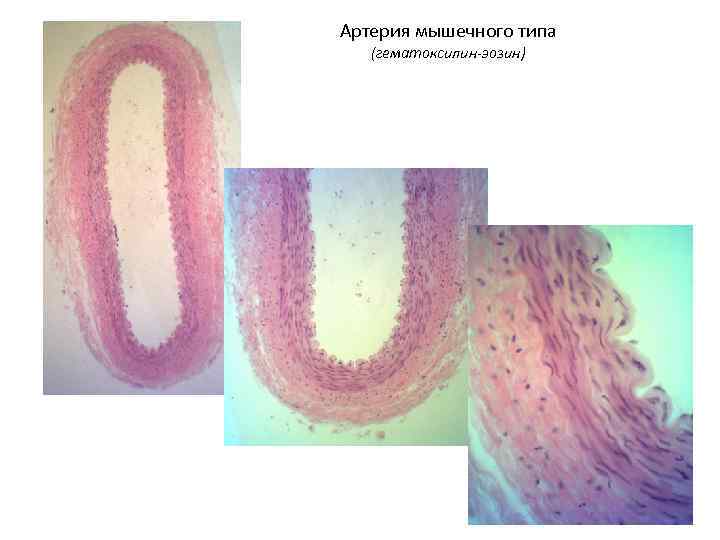 Артерия мышечного типа (гематоксилин-эозин) 