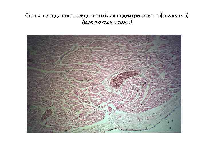 Стенка сердца новорожденного (для педиатрического факультета) (гематоксилин-эозин) 