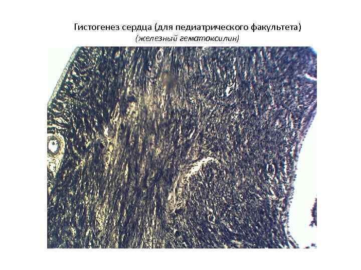 Гистогенез сердца (для педиатрического факультета) (железный гематоксилин) 
