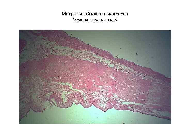 Митральный клапан человека (гематоксилин-эозин) 