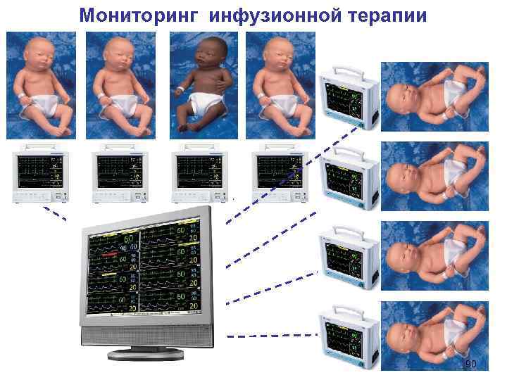 Мониторинг инфузионной терапии 90 