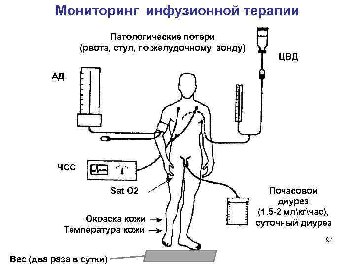  Мониторинг инфузионной терапии Патологические потери (рвота, стул, по желудочному зонду) ЦВД АД ЧСС