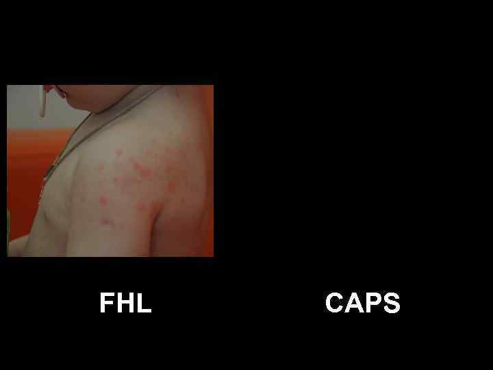 FHL CAPS 