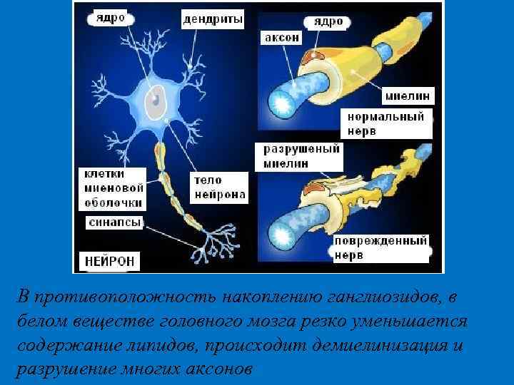 В противоположность накоплению ганглиозидов, в белом веществе головного мозга резко уменьшается содержание липидов, происходит