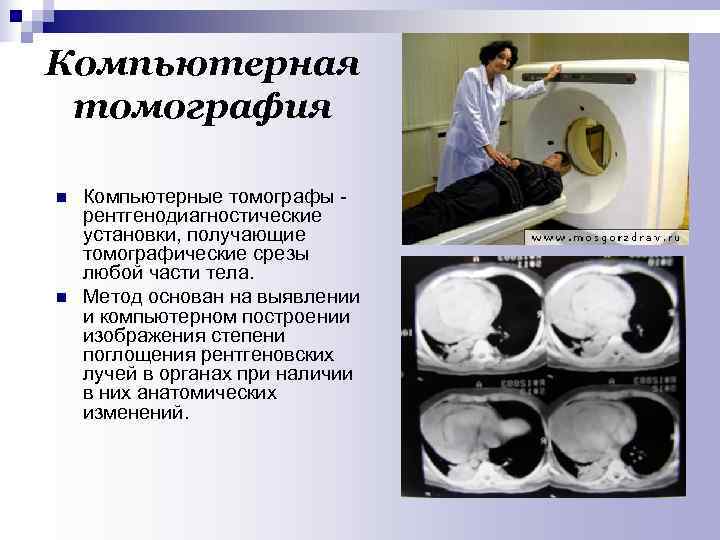 Компьютерная томография n Компьютерные томографы - рентгенодиагностические установки, получающие томографические срезы любой части тела.