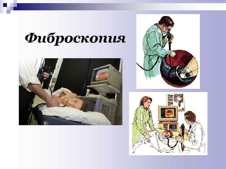 Фиброскопия 