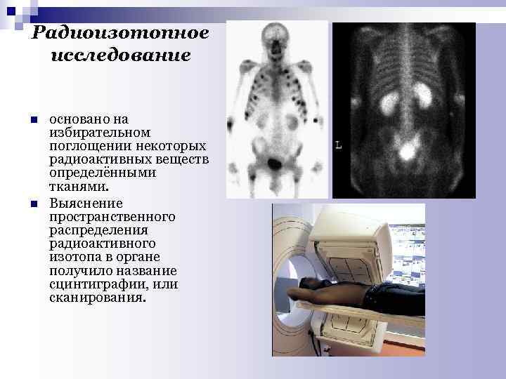 Радиоизотопное исследование n основано на избирательном поглощении некоторых радиоактивных веществ определёнными тканями. n Выяснение