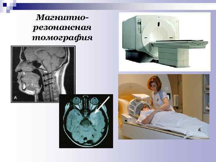  Магнитно- резонансная томография 