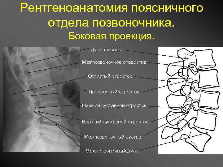 Изменения боковых отделов. С2 позвонок анатомия рентген. Рентген шейных позвонков сбоку. Поясничные позвонки рентген анатомия. Анатомия шейного позвонка рентген.