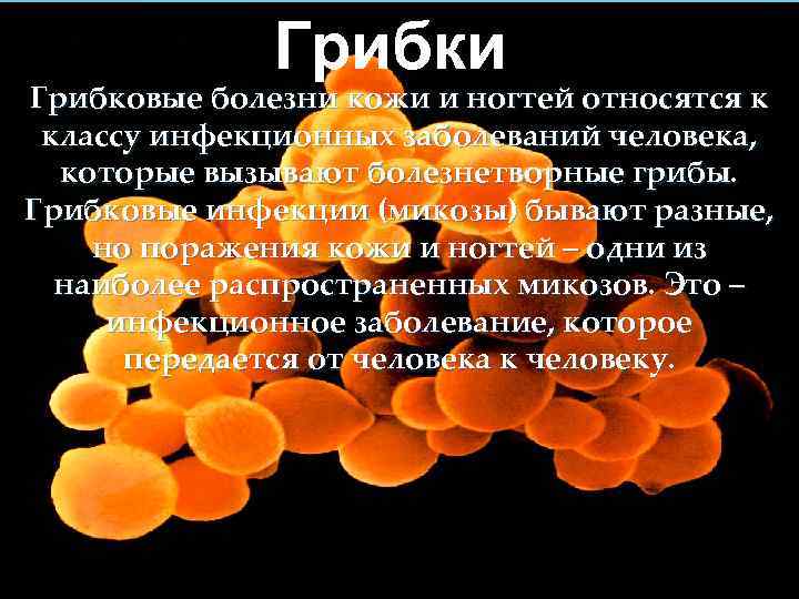  Грибки Грибковые болезни кожи и ногтей относятся к классу инфекционных заболеваний человека, которые