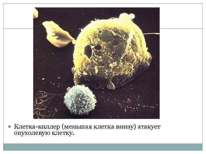  Клетка-киллер (меньшая клетка внизу) атакует опухолевую клетку. 