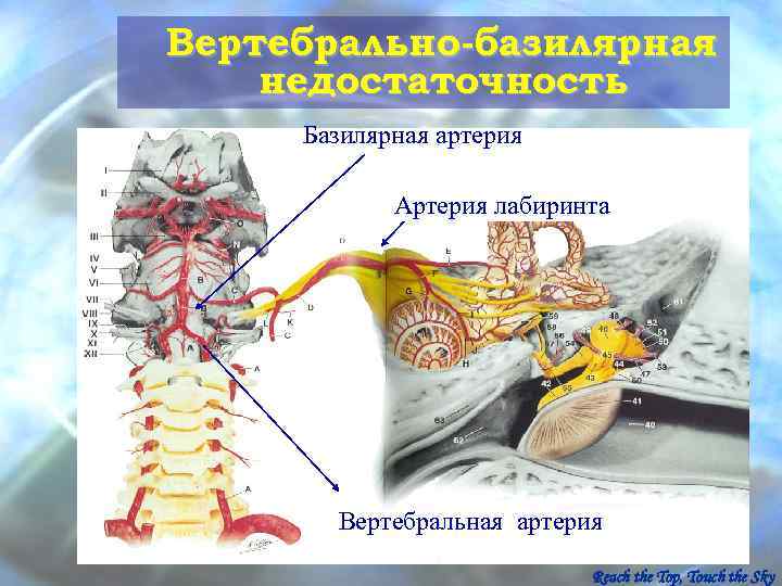 Вертебрально-базилярная недостаточность Базилярная артерия   Артерия лабиринта  Вертебральная артерия   